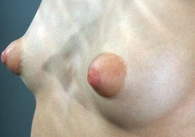 Long Nipple Galleries
